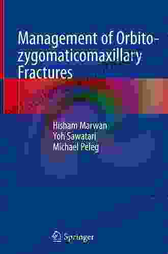 Management Of Orbito Zygomaticomaxillary Fractures S Musheer Hussain