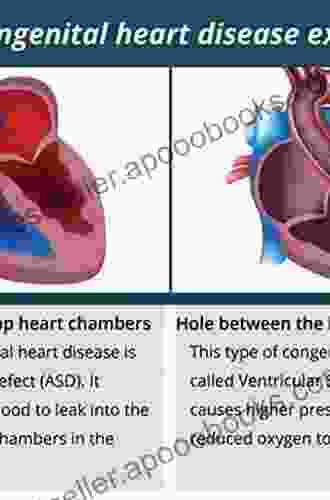 Intensive Care Of The Adult With Congenital Heart Disease (Congenital Heart Disease In Adolescents And Adults)