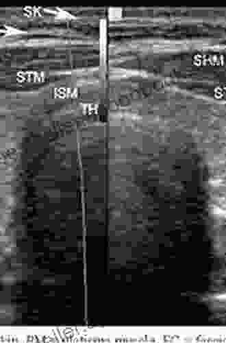 Ultrasound Of The Thyroid And Parathyroid Glands