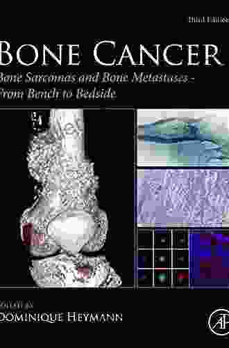 Bone Cancer: Bone Sarcomas and Bone Metastases From Bench to Bedside